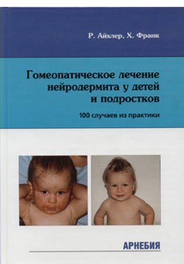 Р.Айхлер, Х.Франк Гомеопатическое лечение нейродермита у детей и подростков (100 случаев из практики)